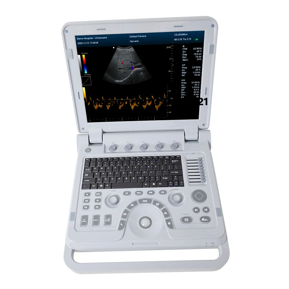 

CONTEC CMS1700A Color Cardiac Ultrasound Ultrasonic Usg Equipment Ultrasound Scan Machine