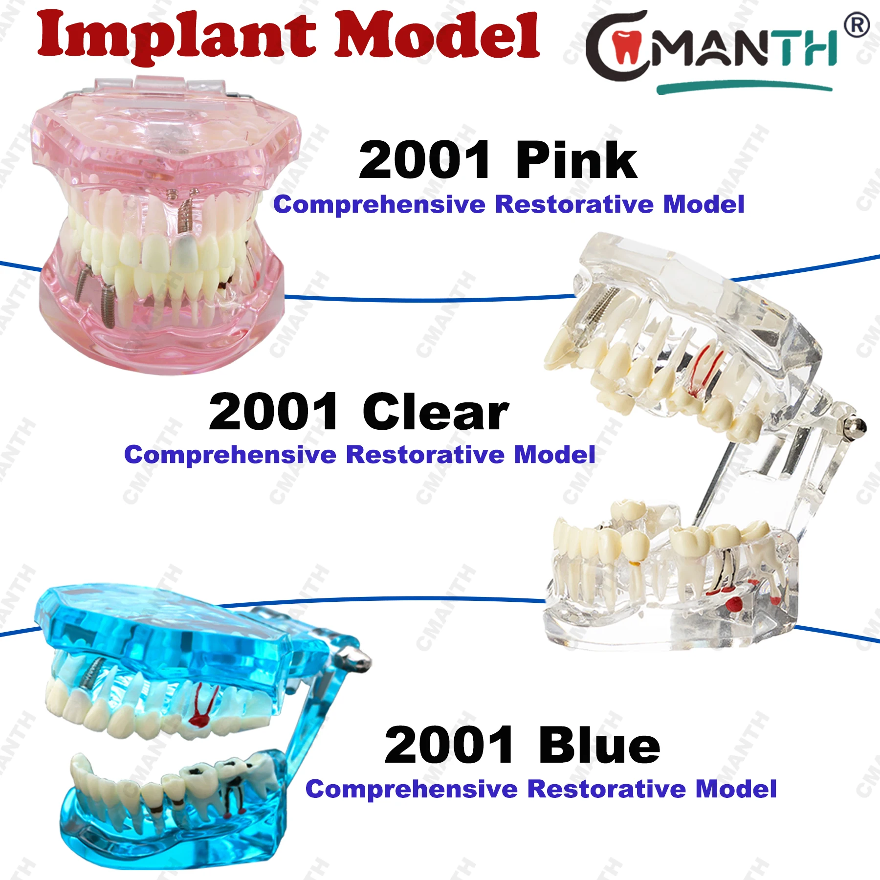 

Стоматологическая модель, имитация зубов, модель из смолы для образования пациентов, демонстрация с реставрационным мостом, обучающая модель, стоматологические изделия