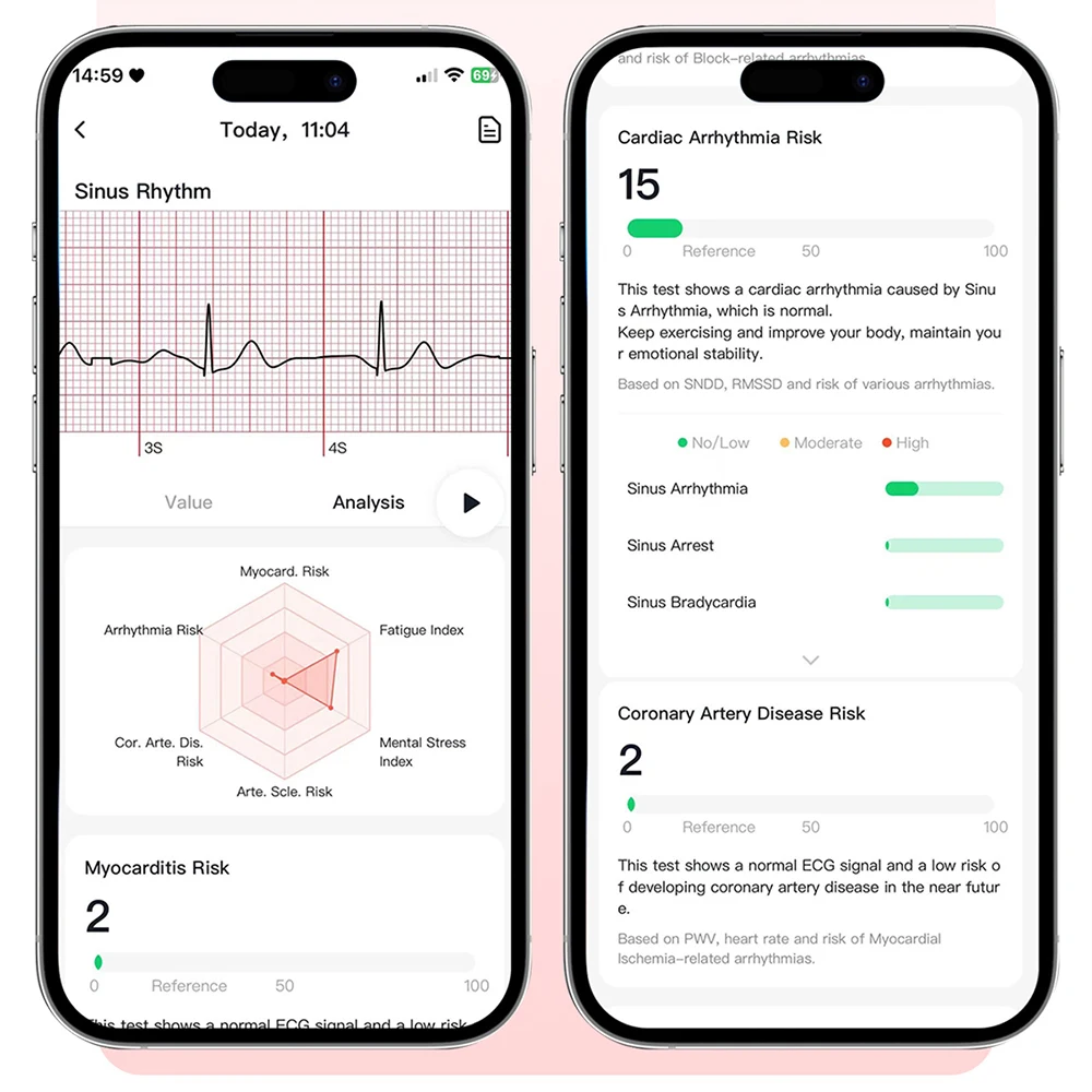 Thumbnail 4 - #49 Best Blood Pressure Monitors to Buy In 2026