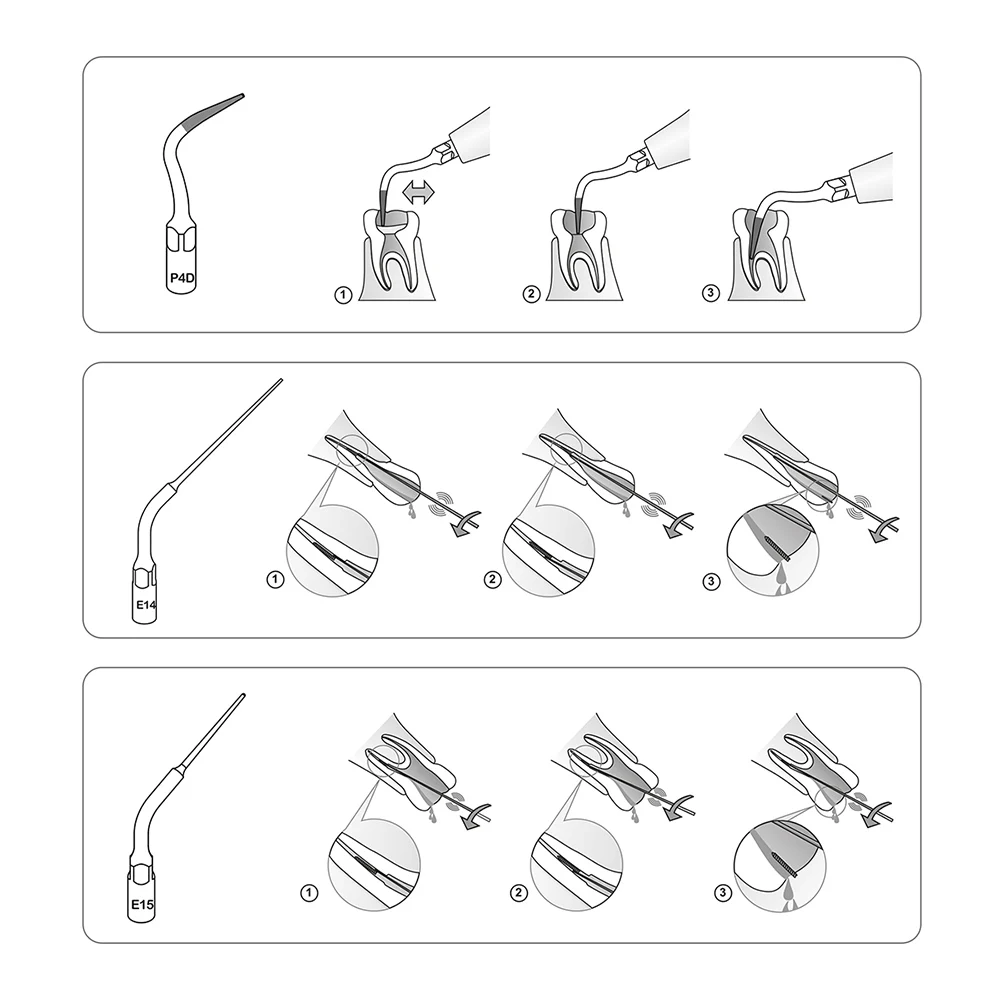 AZDENT-escalador ultrasónico Dental, puntas de escalado para EMS WOODPECKE, piezas de mano, E1, E2, E3, P1, P3, G1, G3