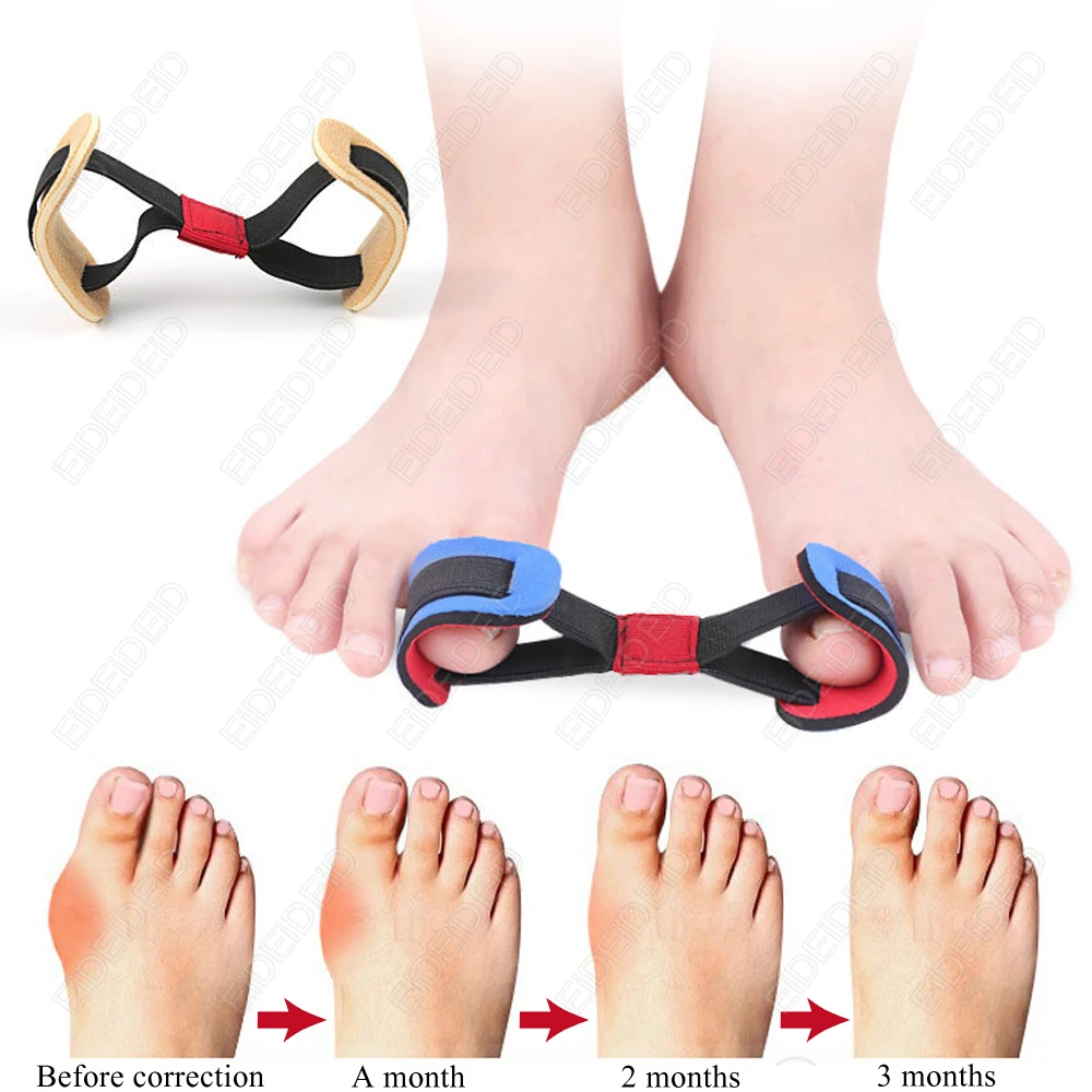 1-2 PCS Unisex Bunion Corrector Strap Stretchy Big Toe Strap Hallux Valgus Alignment Relief Foot Pain Relief