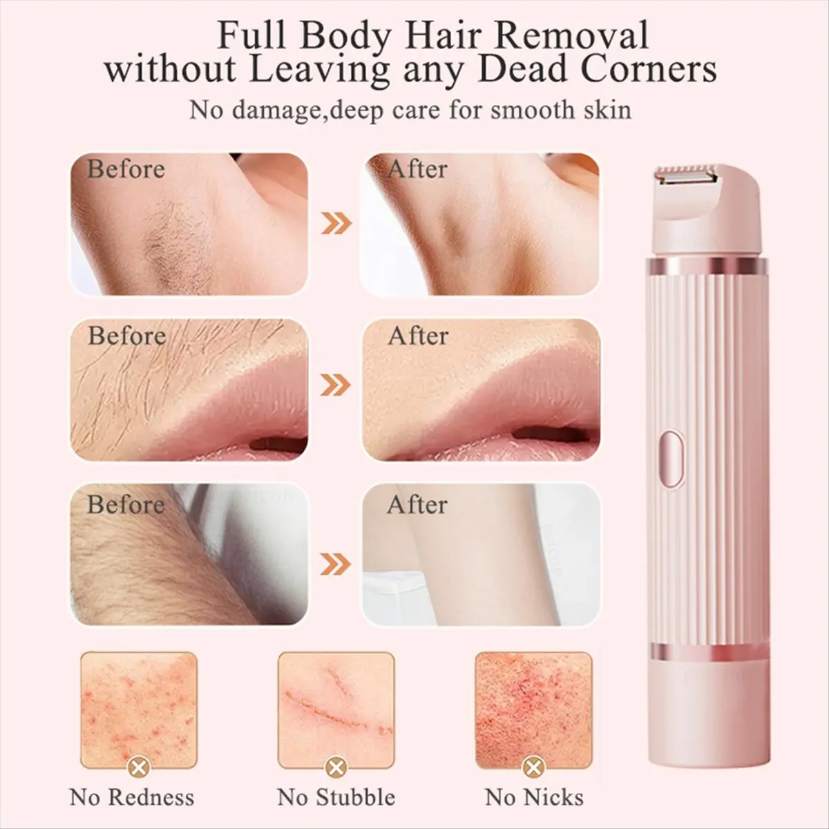 

ABPO Electric Shaver for Women Bikini Trimmer Facial Mustache Hair Removal Ladies Face Underarm Legs Electric Epilator