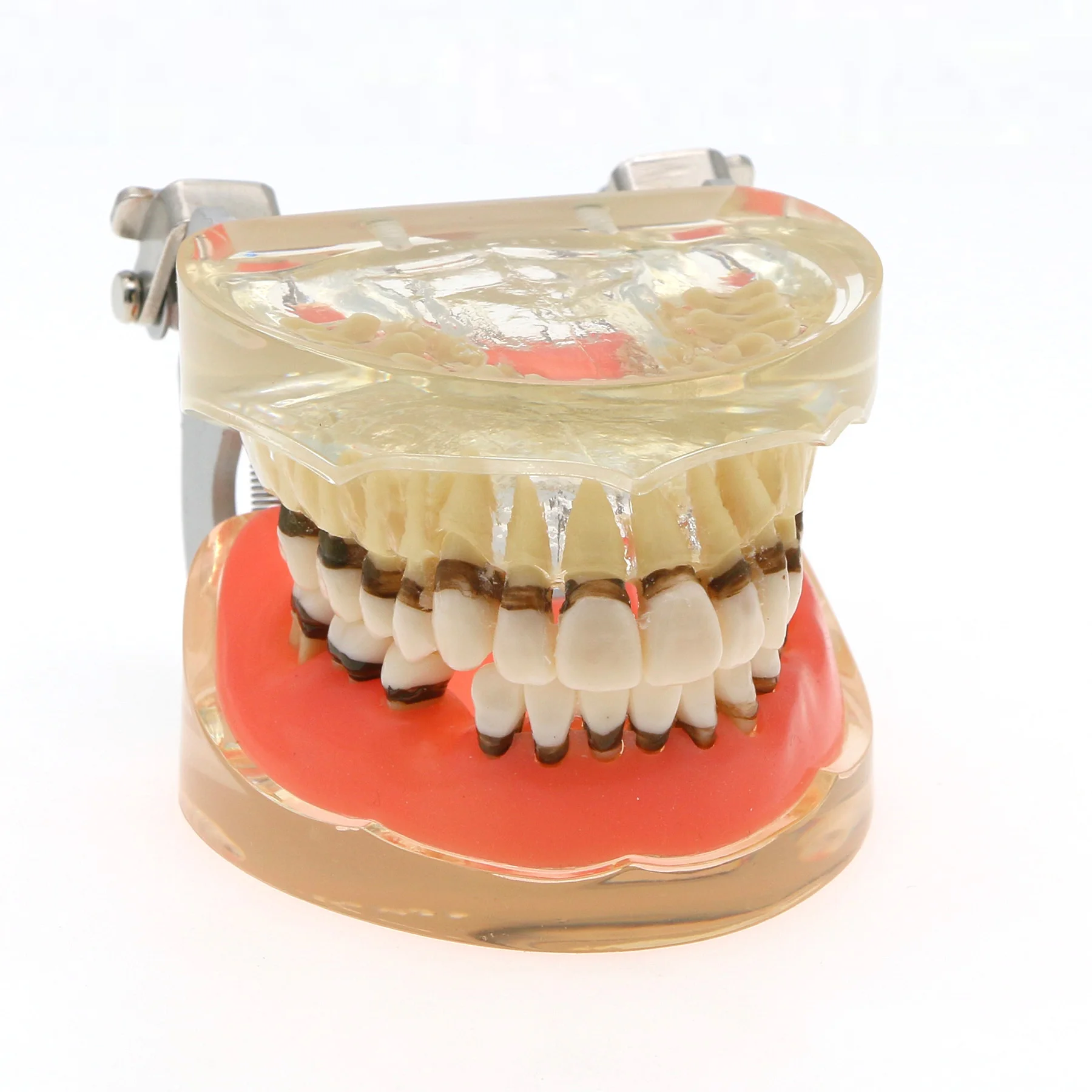 Dental Model Periodontal Disease Teeth Model With Replacment Gingivae For Teaching Educational Dentistry Laboratory Material