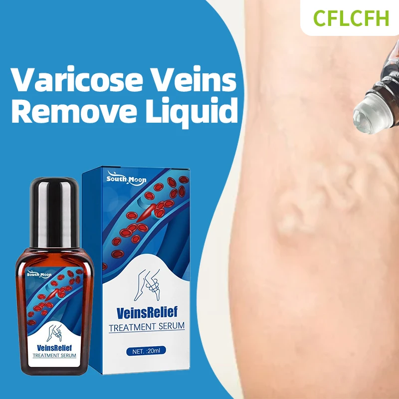 

Varicose Veins Relief Liquid For Spider Leg Varicosity Vasculitis Phlebitis Angiitis Legs Dilated Treatment Foot Care Medicine