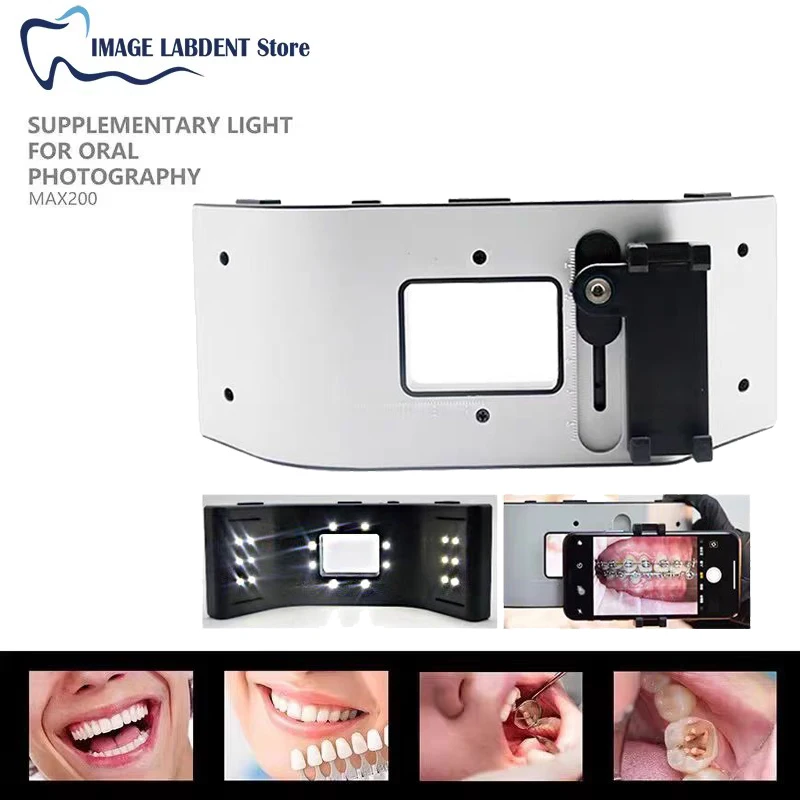 

Dental Oral Filling Lamp Photography Fotografia Orthodontics Flash Light Equipment Environment Photo Lamp