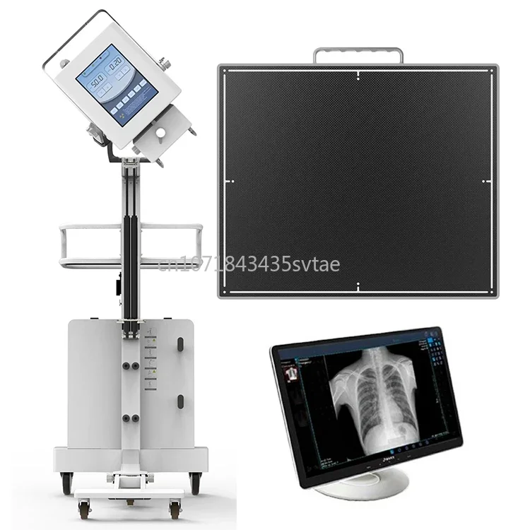 Hot Selling 14 X 17 Rayos X Detector De Panel Plano X Ray Machine Price In Pakistan