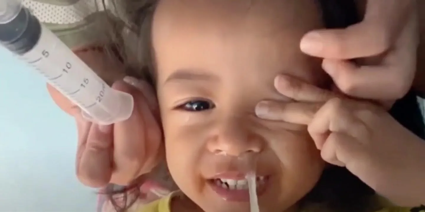 Silicone Baby Nasal Aspirator Syringe Baby Nose Cleaner Kids Rhinitis Nasal Washer Reusable Nasal Irrigator Washing for Children