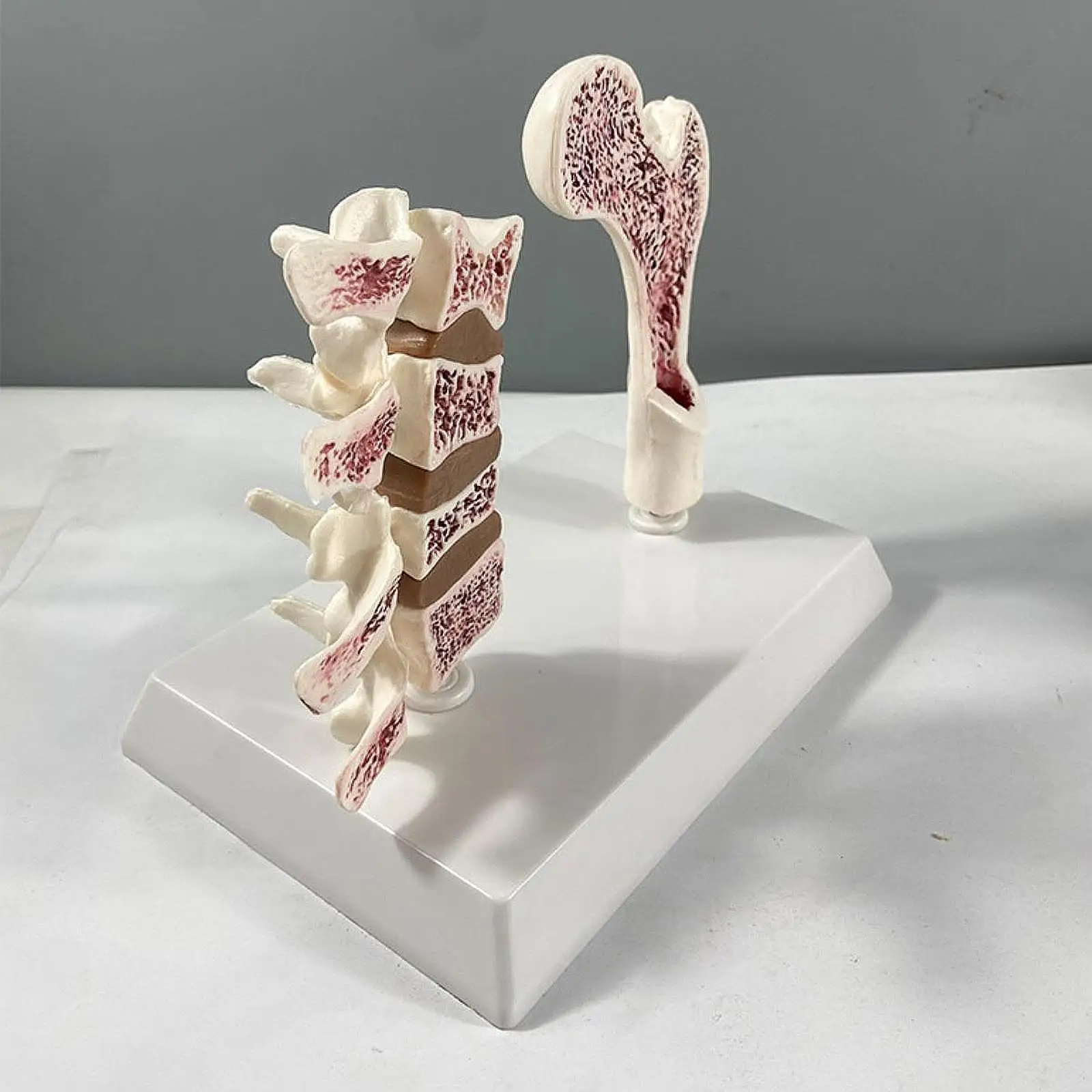 Human Femur Osteoporosis Anatomy Model, Include Leg Bone and Spine, Sturdy Versatile Learn Props Educational Tool for Home