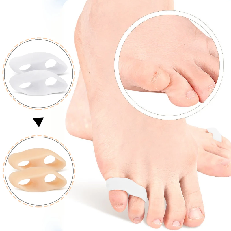 1Pair Piedi In Silicone Cura Gel Toe Correttore Protezione Piastre Separatori Sovrapposte Alluce Valgo Borsite Alleviare Il Dolore