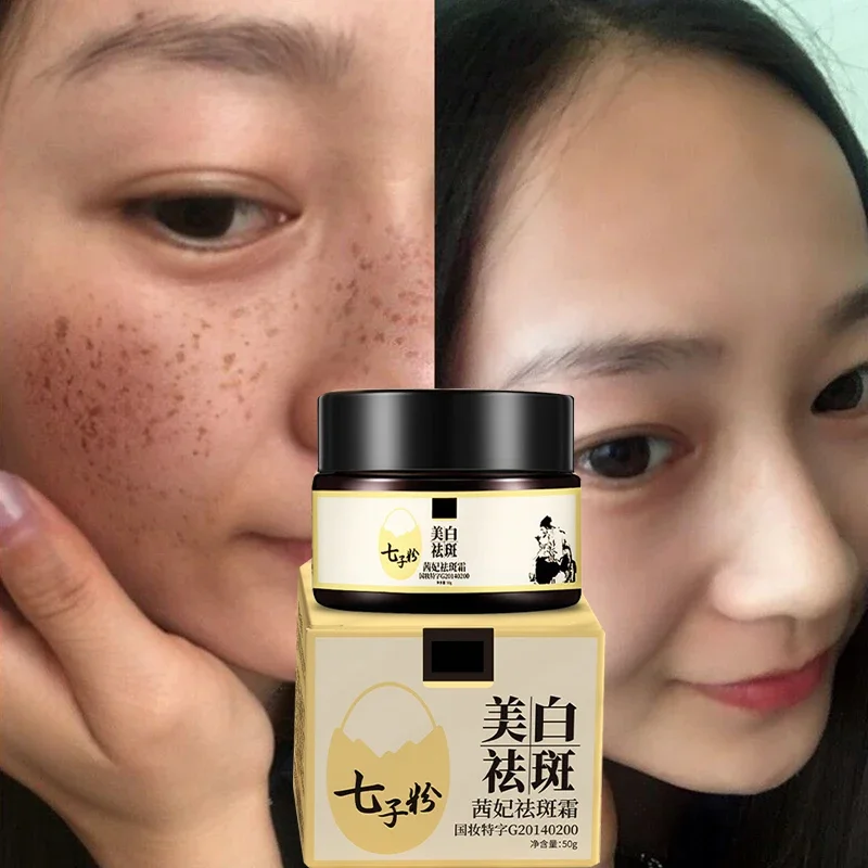 Seven Seeds Powder Whitening Spot Removal Cream Moisturizing Light spots skin super moisturizing herbal essence cream Skin care