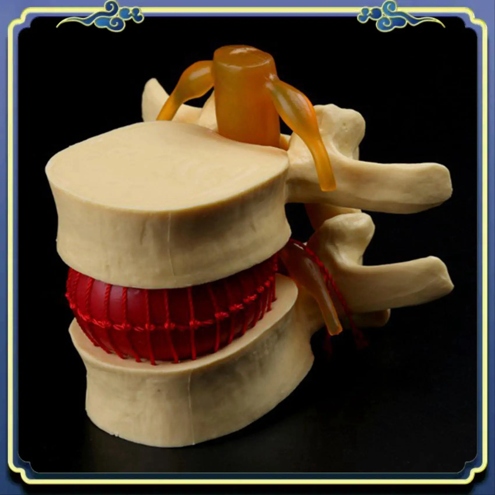

Portable 2X Lumbar Vertebrae Model Anatomical Spine Lumbar Disc Herniation Anatomy Teaching Tool Lumbar Vertebrae Model