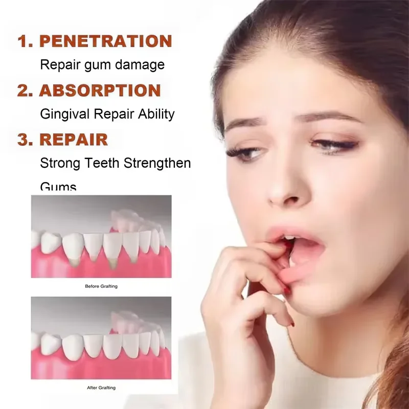 Thumbnail 2 - #49 Most Reviewed Toothpaste