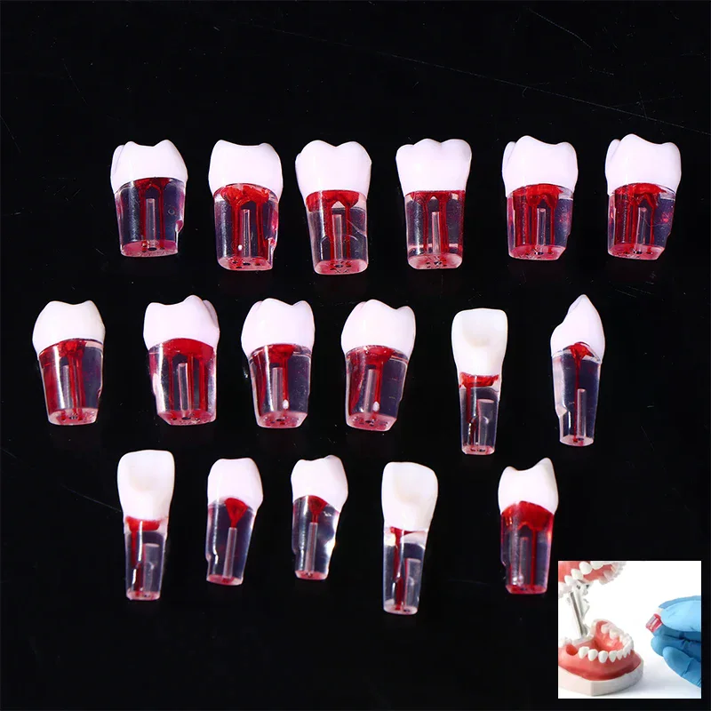 

5/10 шт., модель зубов RCT, эндодонтическая практика, блок корневых каналов, целлюлоза, полость смолы, исследование зубов, стоматология, обучающий материал