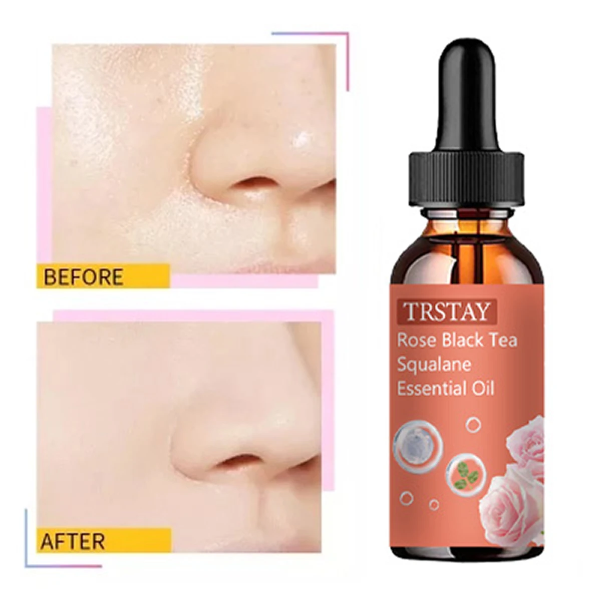 

Rose black tea squalane essence can prevent dullness, dry, moisturize, whiten, resist wrinkles and tighten skin