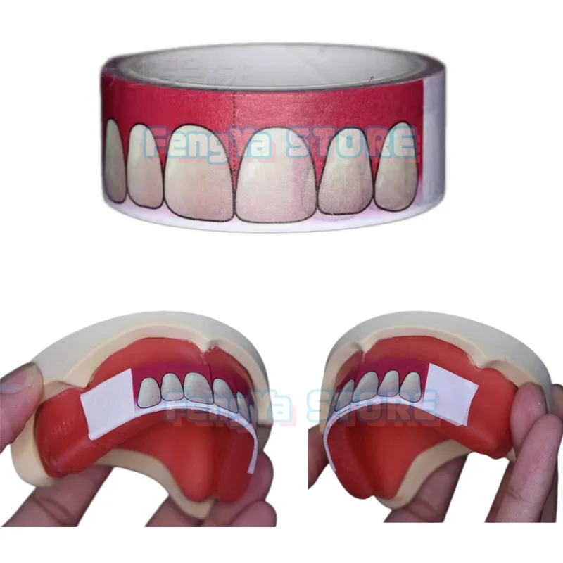 

2 рулона/6 метров: Стоматологические клейкие наклейки для позиционирования передних зубов с резаком для точного позиционирования, материалы для зуботехнических лабораторий