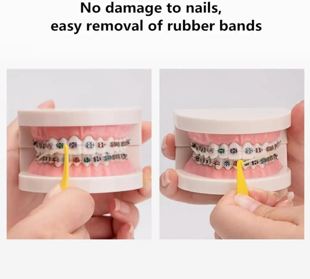 AG 100Pcs Disposable Dental Orthodontic Elastic Placer for Braces Bands Orthodontic Rubber Ligature Ties Ring Dental Accessories view 4