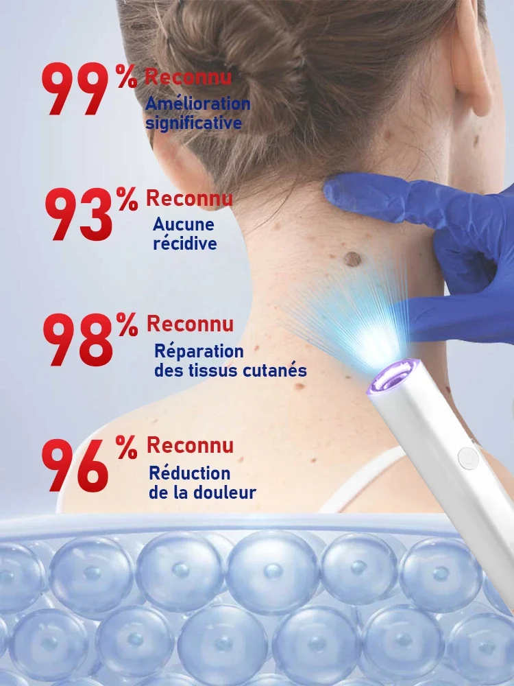2. generacja ulepszona, szybko usuwa brodawki, naprawia brodawki, rozwiązuje problemy skóry i szybko eliminuje znamiona.