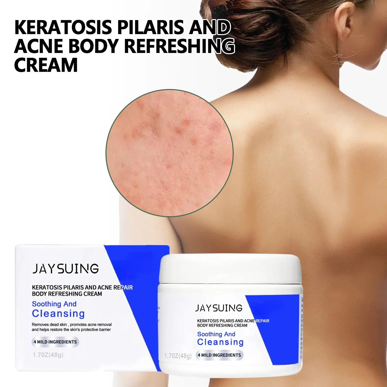 Jaysuking-crema reparadora de queratosis para el cabello, crema reparadora de la piel, limpieza corporal, reparación de espalda, hombro, acné, piel suave, crema iluminadora para la piel oscura