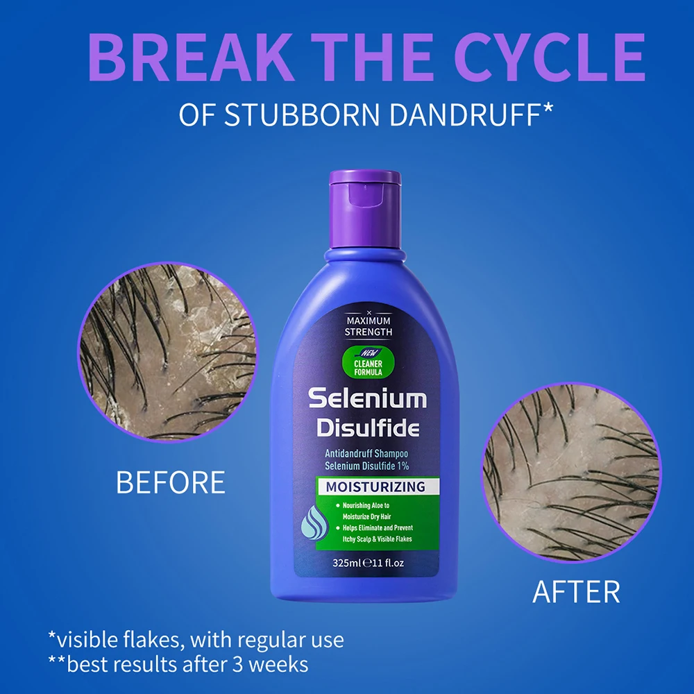 Hair Care Sulfur Dioxide Shampoo Improve Dry Frizzy Split Ends Hair Long Lasting Fragrance Smooth Hair Cleansing Scalp Shampoo