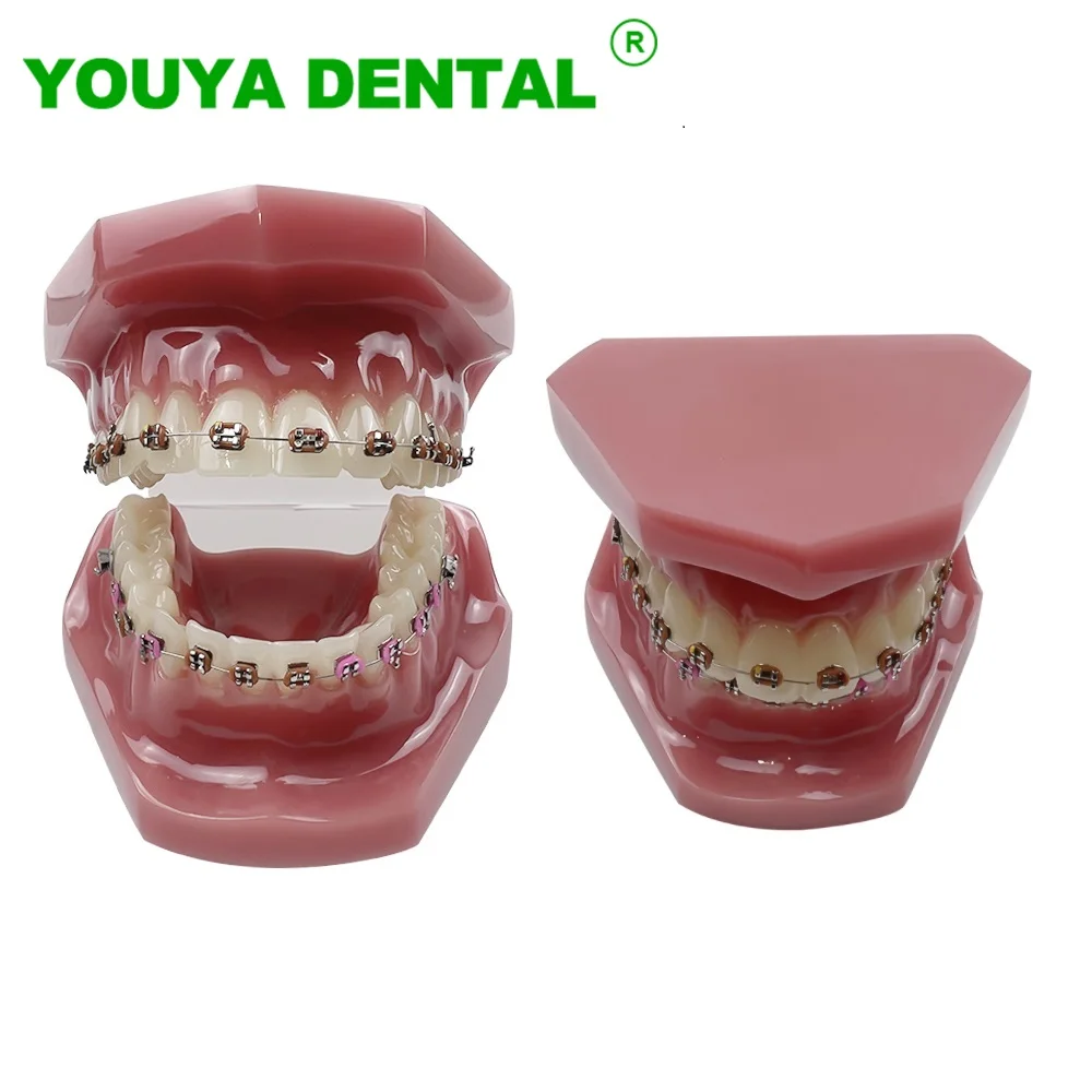 Dental Orthodontic Teeth Model With Metal Brackets Ligature Ties Ortho Treatment Typodont Dentist Tool For Patient Communication