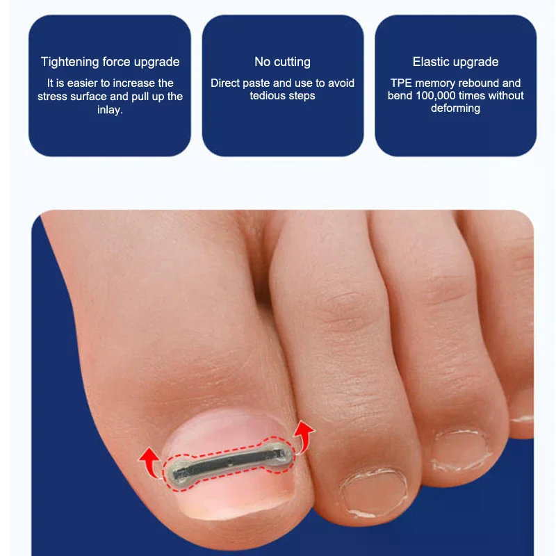 12個のチタン合金陥入爪治療キット - ペディキュアケア用の4つのマルチサイズ湾曲爪矯正ツール