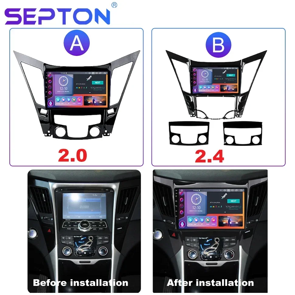 SEPTON 8+256G Automotive Car Radio for Hyundai Sonata8 YF Android All-in-one 2009 - 2015 GPS Multimedia Player Car Stereo Radio