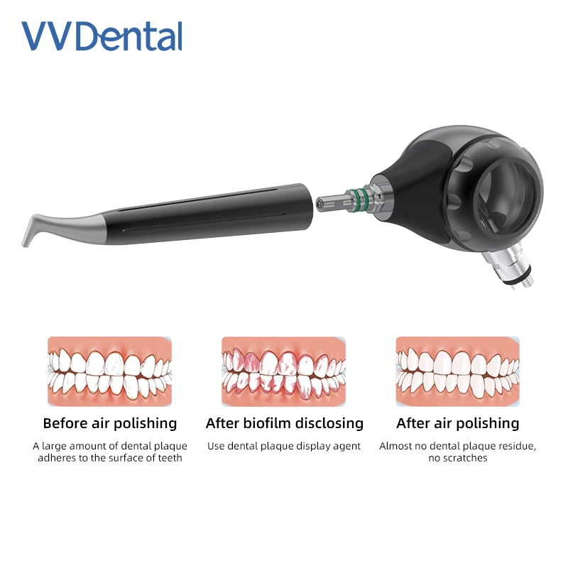 

VV Dental Air Prophy Unit Sandblasting Gun Teeth Whitening/Cleaning Polisher Alumina Pen 2/4 Holes Spray Jet Dentistry Tools