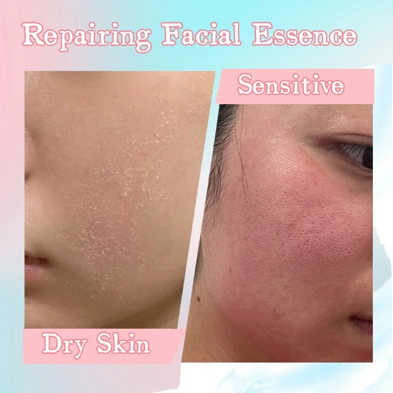 Japan Sakura Serum Facial Care Set Facial Mask Cream Moisturize Wrinkles Spots Remove Enlarged Pores Skin Not Smooth 1/3PCS