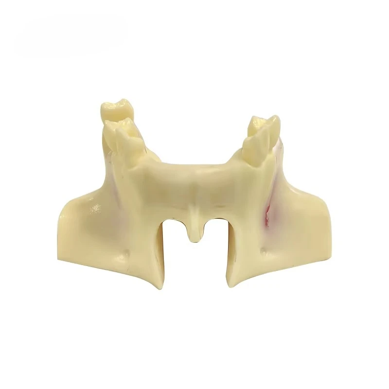 Modelo de dientes de práctica de elevación sinusal UM-Z14
