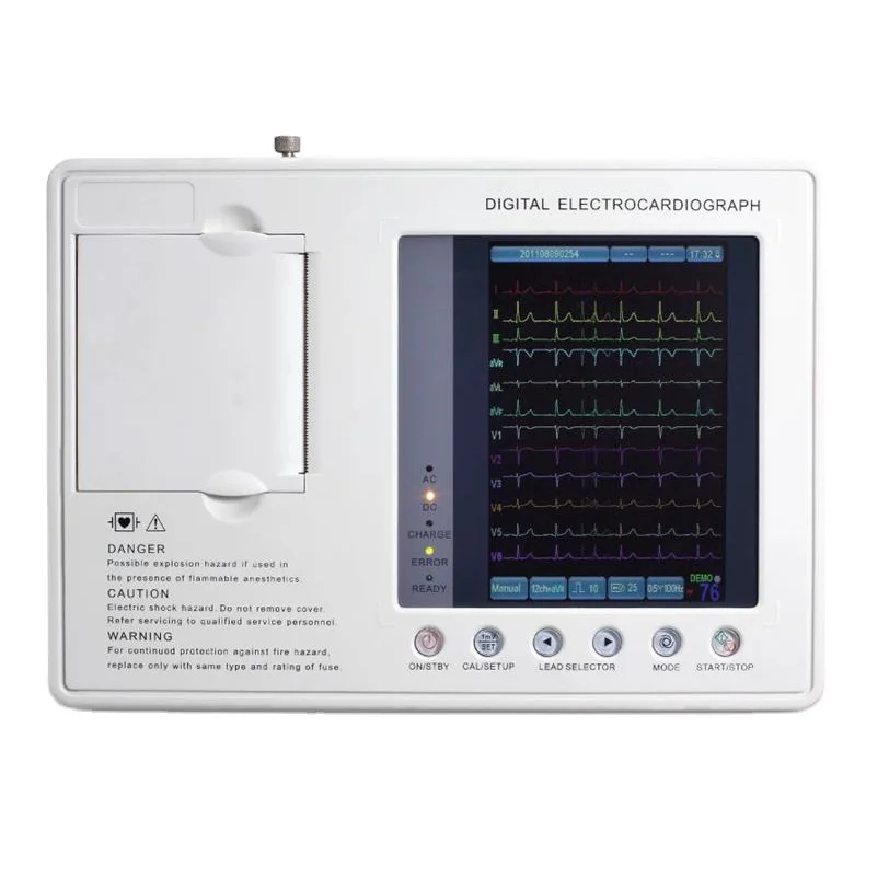 ECG-MK1203C digital 3 channel 12 lead ECG/EKG machine portable electrocardiograph price