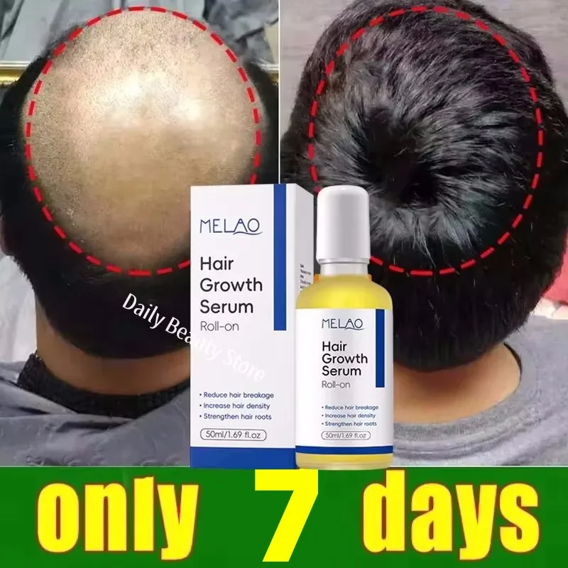 

Fast Hair Growth Serum 7 Days Anti Hair Loss Prevent Baldness Scalp Treatment Repair Roots Beauty Health Hair Care For Men Women