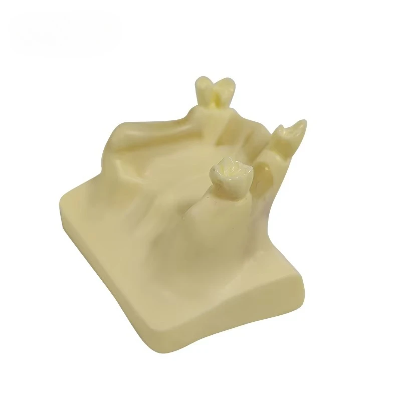 Modelo de dientes de práctica de elevación sinusal UM-Z14