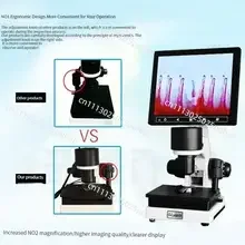 High-Definition Observation & Analysis of XW-880 Fingernail Fold Peripheral Blood Flow Velocity