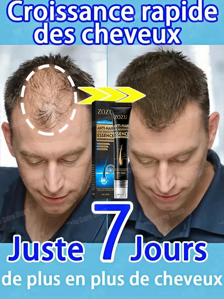 

accelerates hair growth, penetrates deep into the hair roots, hair oil for fast growth