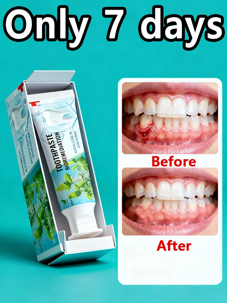 

Вау! Эта зубная паста стирает пятна кофе в 1 неделю! Никаких чувствительных зубов! Эта зубная паста — это сменщик игр!