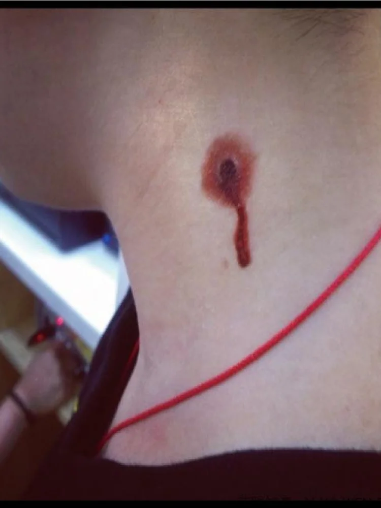 Tatuaje impermeable Stiers loween Par herida Reatic mancha de sangre cicatriz broma Stiers aguja costura aspecto auténtico