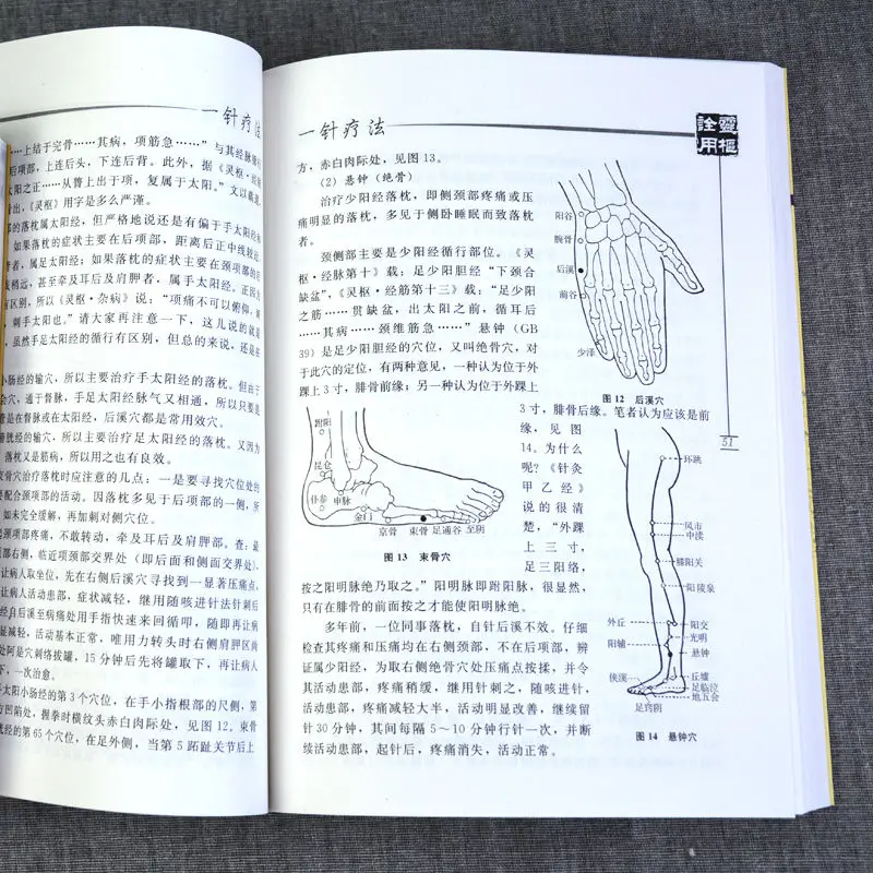 3本の鍼治療の本,孔雀の鍼治療,1本の針療法,伝統的な中国の薬,本