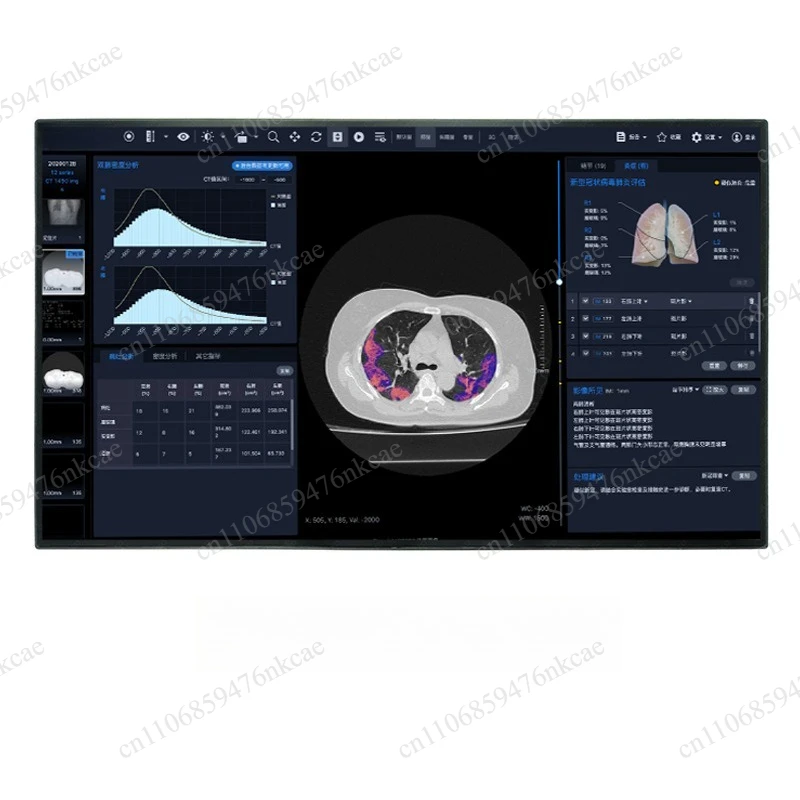LM315WR1-SSB2 31.5 Inch 4K 3840*2160 IPS LCD Screen Industrial Medical Imaging Display