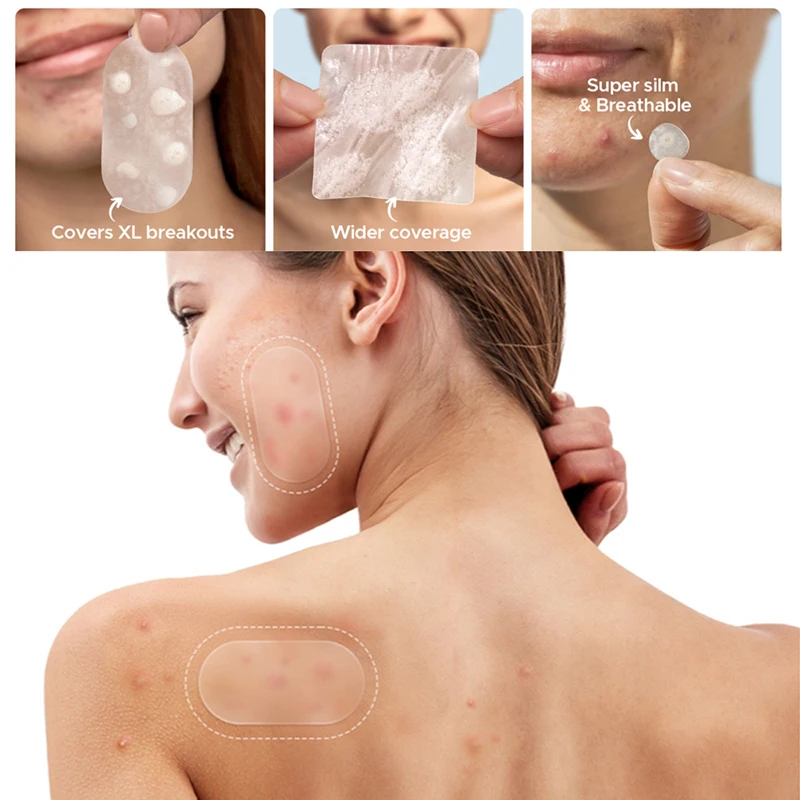 New 116Pcs Invisible Anti-Acne Repair Patches - Pimple Removal Spots Marks Concealer Beauty Makeup Tool For Facial Blemish Care