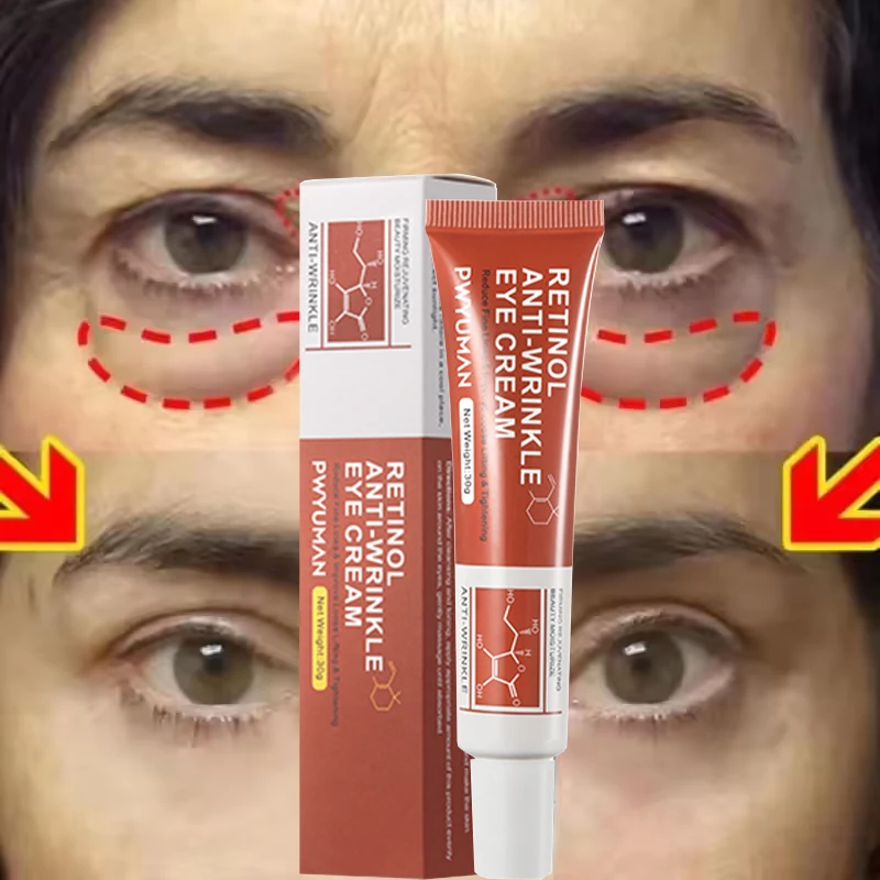 

Instant Eye Bag Removal Cream Retinol Anti-Wrinkle Firming Skin Fade Fine Lines Anti Dark Circle Puffiness Brighten Eye Care