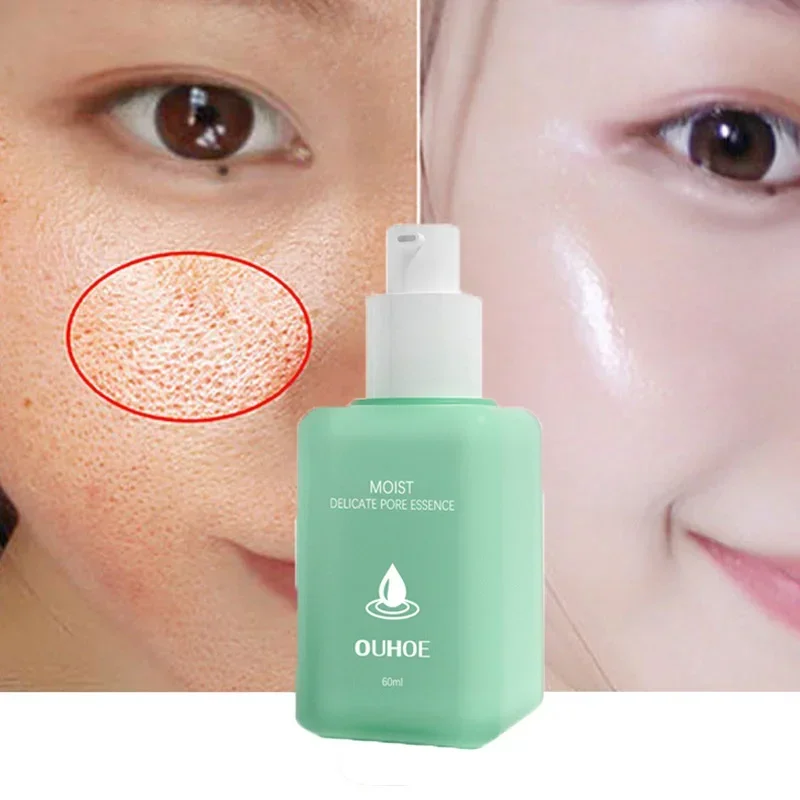 Hyaluronic Acid Essence To Get Rid of Closed Acne Blackheads Lactose Acid Serum To Solve Enlarged Pores Brighten The Facial Skin