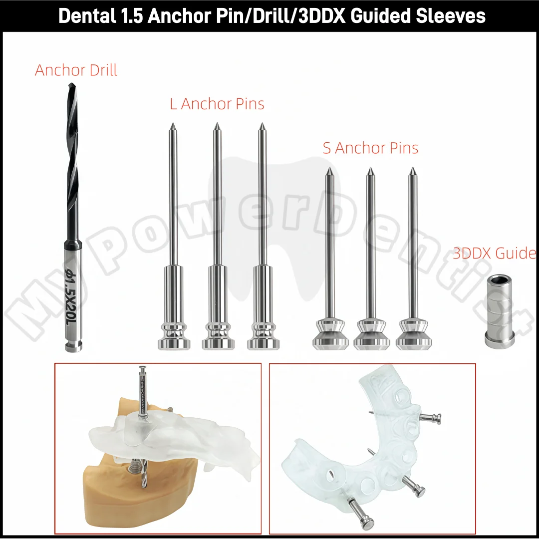 Dental 3DDX Guided Anchor Pin Sleeves Guided Anchor Drill Digital Implant Guided Template Fixation Dia.1.5