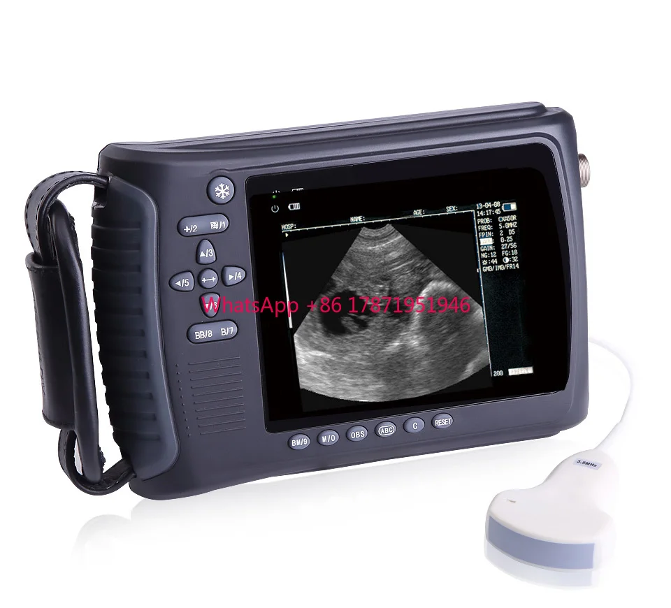 2021 Full Digital Palmtop Bladder Ultrasound Scanner Color Ultrasound Machine With Convex