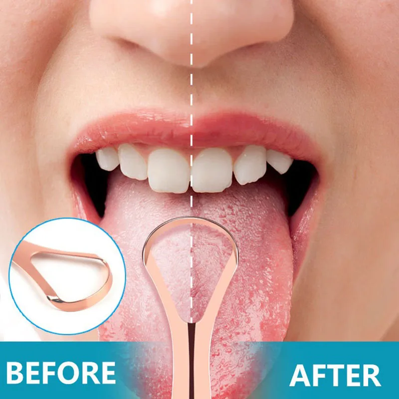 1Pc/2/4/10//20/50Pcs Dental Stainless Steel Tongue Scraper Bad Breath  Tongue Coating Cleaner Oral Care Tools Large/Small