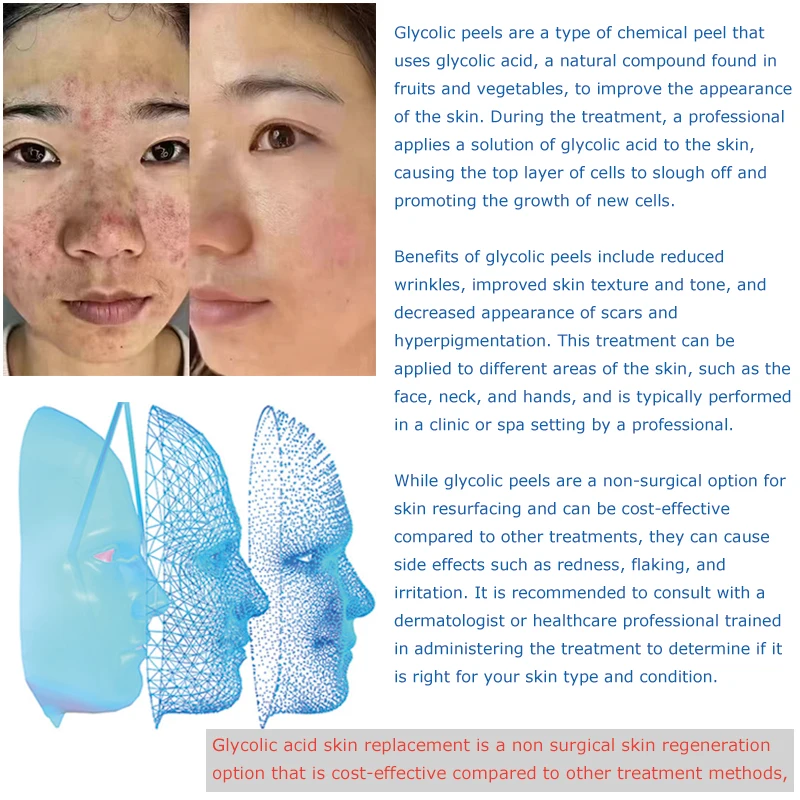 Glycolic Acid Peel AHA 10% 20% 30% neutralizer Alpha-Hydroxy Acid Peel Facial Beauty Treatment Skincare Routine Dermatology