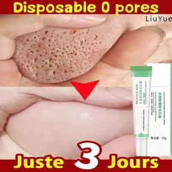 Delicado Po e re Creme, Gel Reparador, Eliminar a Melanina, Melhorar o Nariz, Hidratante, Rosto, Clareamento da Pele, Cuidados de Beleza