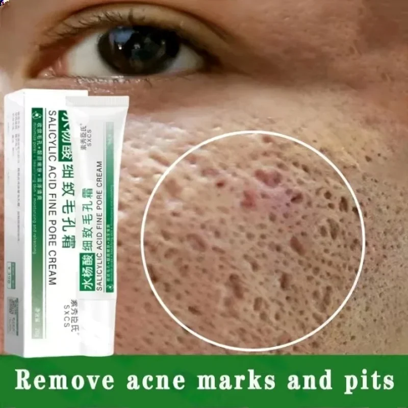 Salicylic Acid Pore Clearing Cream Shrink Pores Remove Blackheads Acne Brighten Moisturizing Smooth Skin Care Korean Products