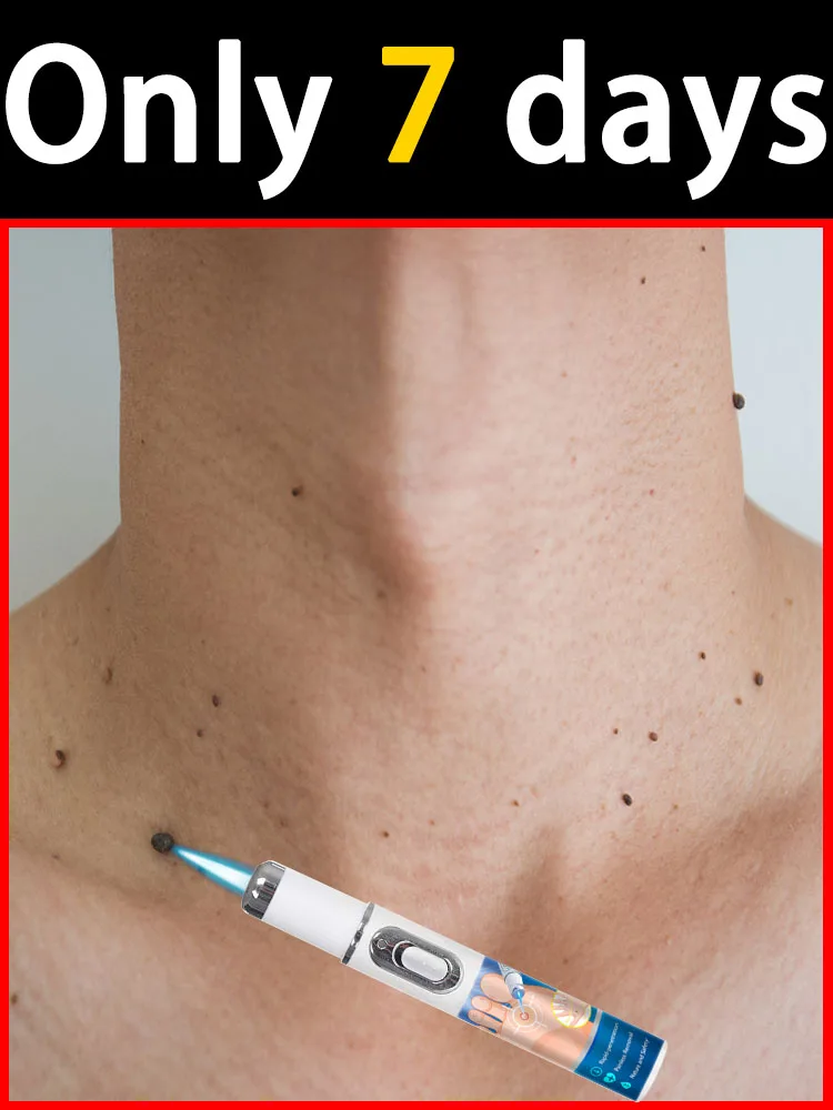 يمكن التحكم في المسافة والمدة بالليزر من الجيل الثاني بشكل مستقل، أداة العناية باللحام بحل الليزر الأزرق الجديد #1