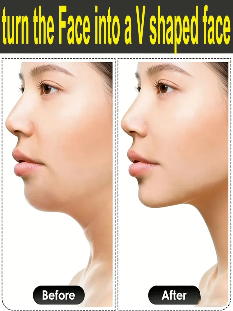 Tighten The facial jawline and turn the Face into a V shaped face
