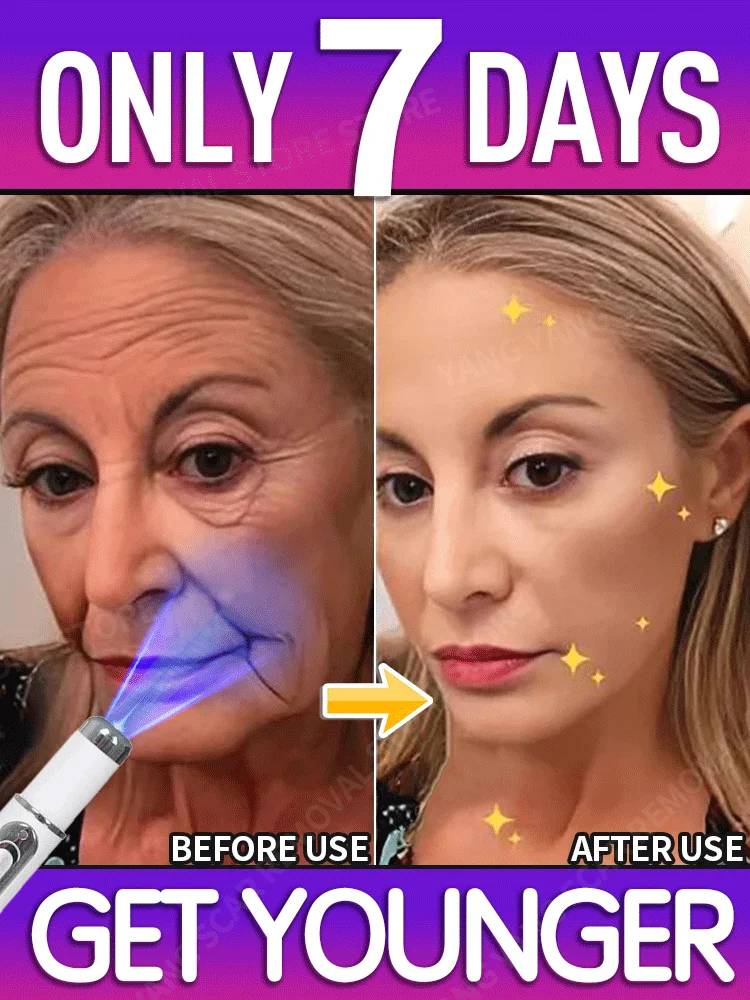 Solve wrinkles problems and make you 20 years younger